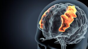 mecanismos implicados en la nuroplasticidad